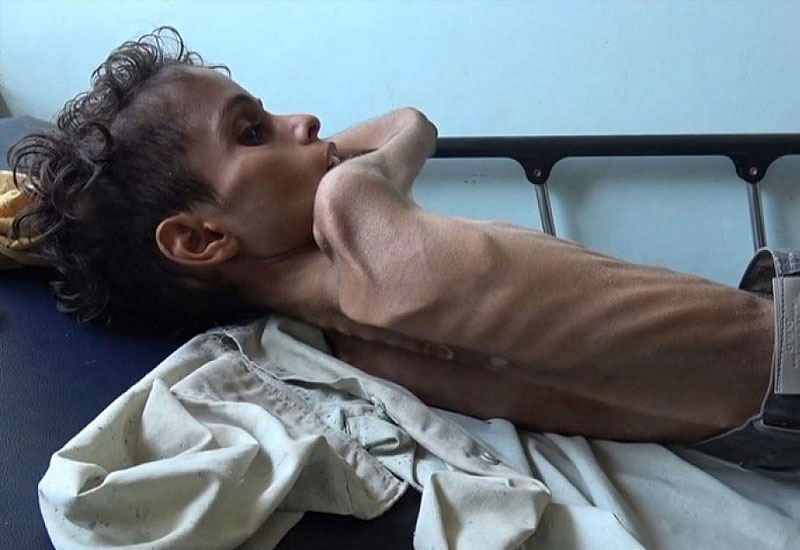 ООН: Йемен рискует столкнуться с голодом уже в первой половине 2022 года